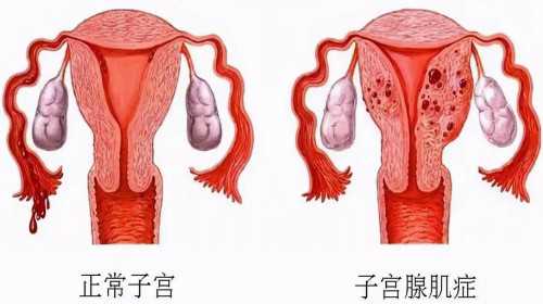 北京三代试管大概费用 北京空军总医院试管婴儿医生评价 ‘孕17周b超男宝小鸡